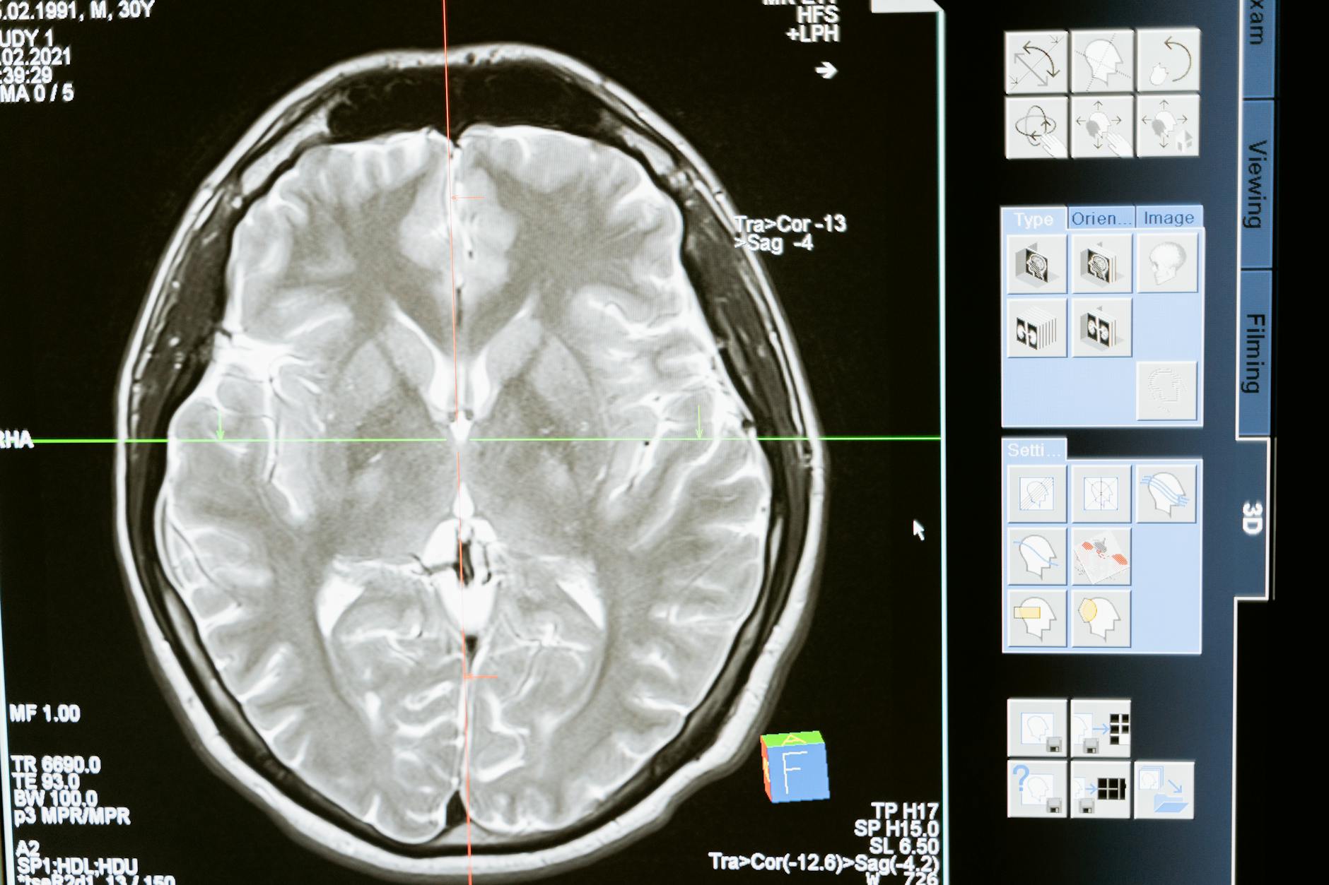 Beyond Limits: The Science Behind Addiction and Factors Influencing Consumption